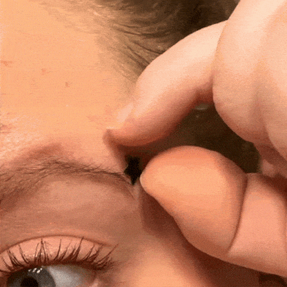 Sentia Yıldız Sivilce Bandı (40lı paket)