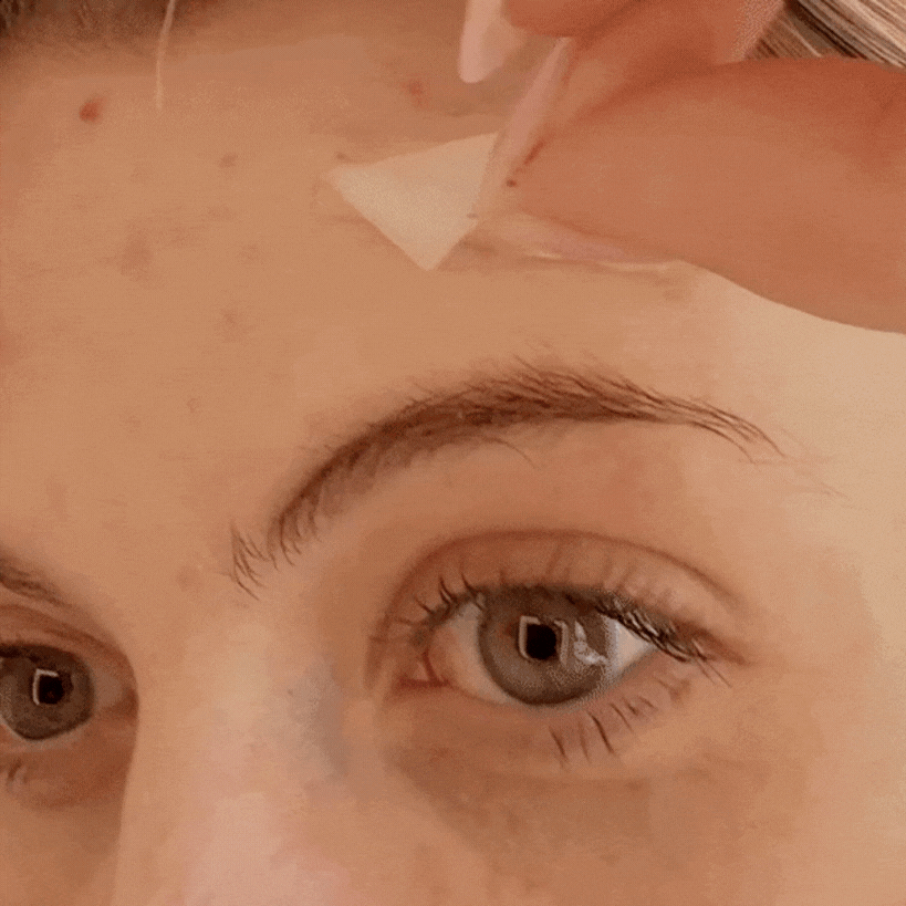 Hidrokolloid Bant Roll